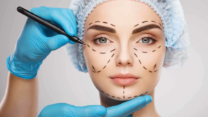 Best Plastic Surgery Hospital in Paschim Vihar