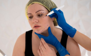 Best Plastic surgeon treatment in Paschim Vihar