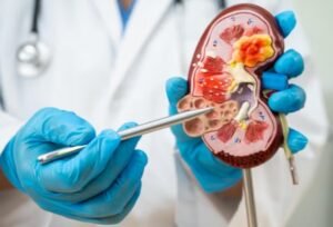 best urology treatment in Paschim Vihar